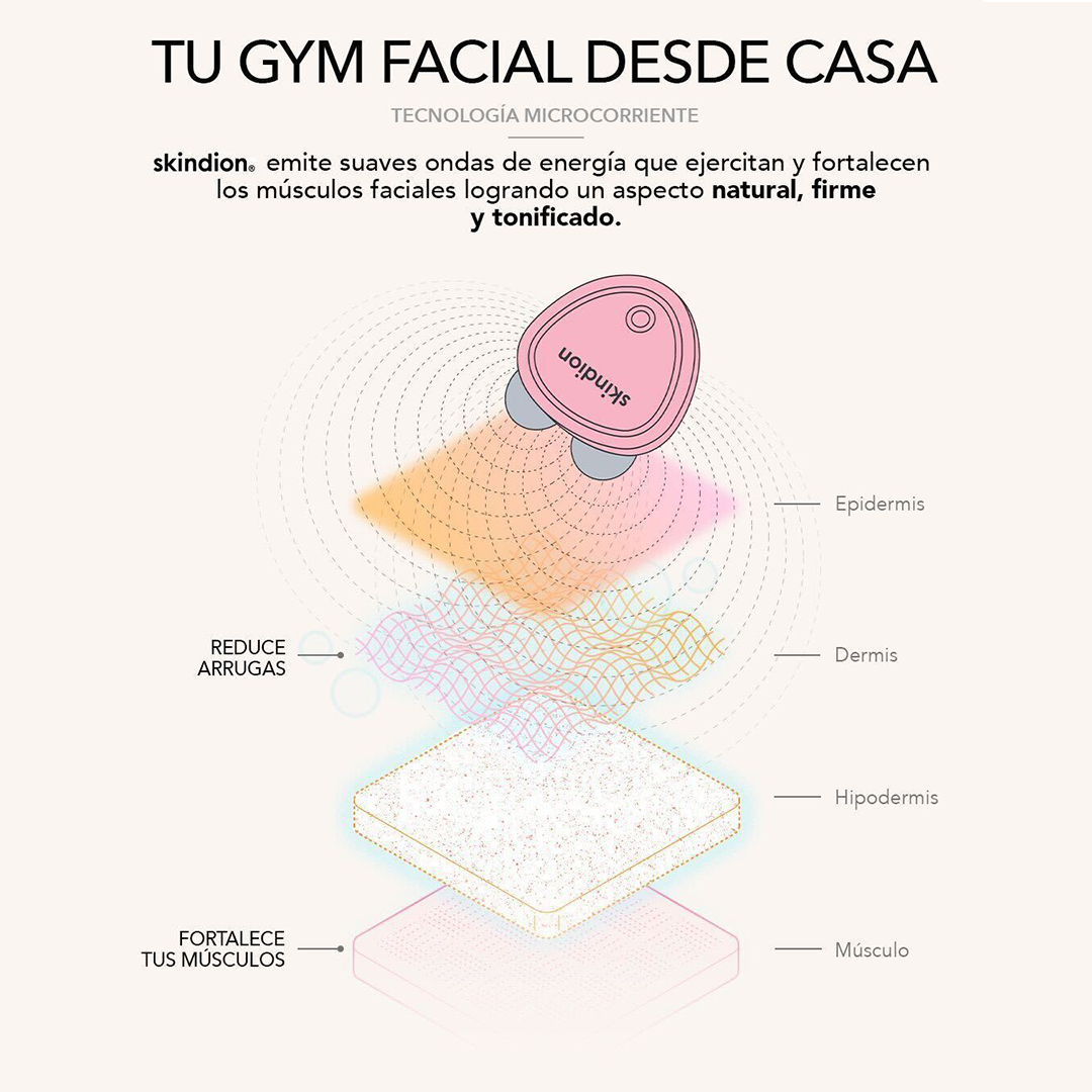 Cómo funciona